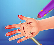 Hand Doctor